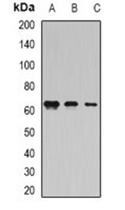 Western blot analysis of MCF7 (Lane1), HepG2 (Lane2), rat testis (Lane3) whole cell lysates using COIL antibody