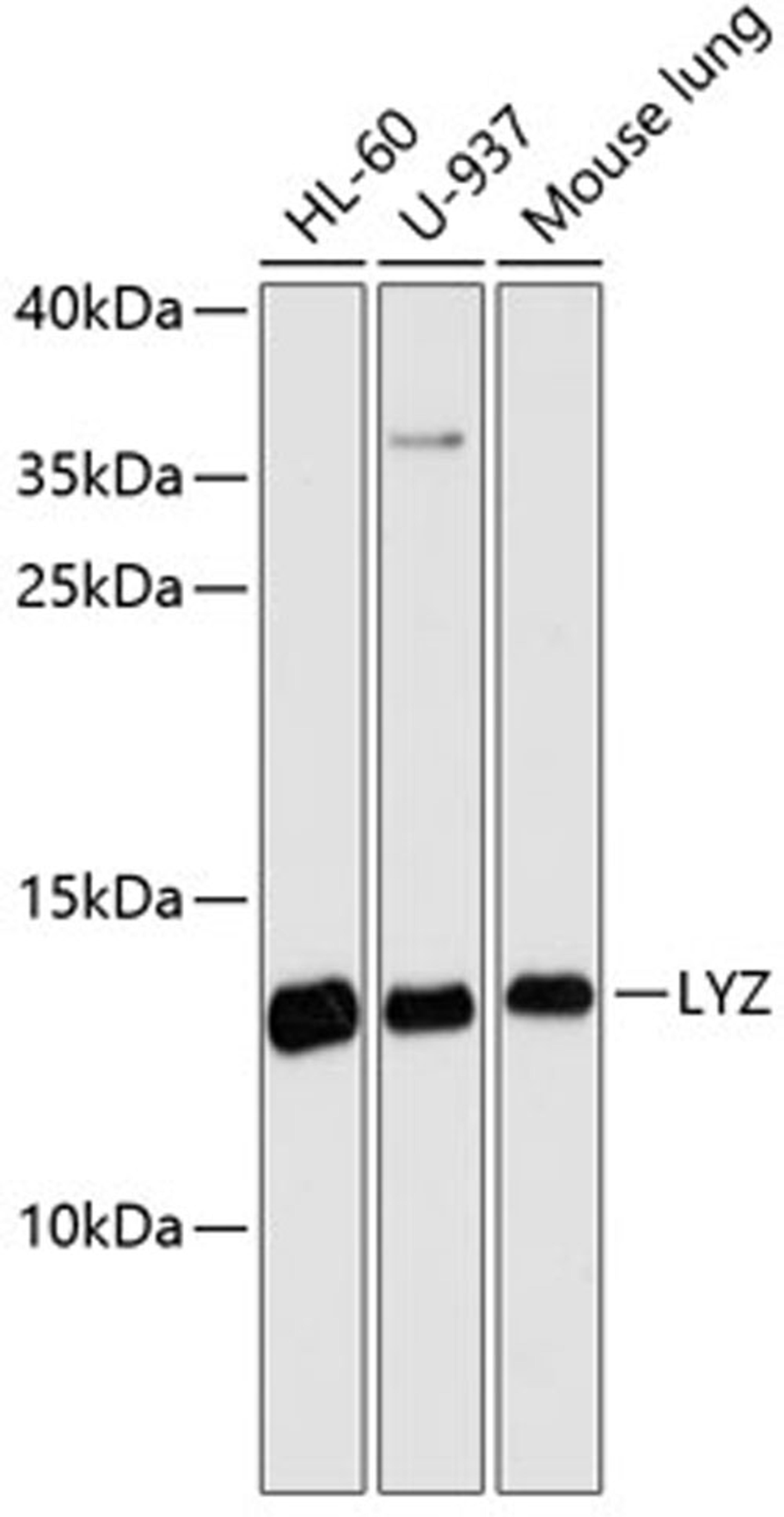 Western blot - LYZ antibody (A13511)