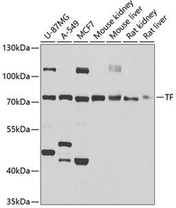 Western blot - TF antibody (A1448)