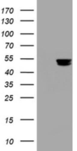 Western Blot: PD-ECGF/Thymidine Phosphorylase Antibody (7A6) [NBP2-45397] - Analysis of HEK293T cells were transfected with the pCMV6-ENTRY control (Left lane) or pCMV6-ENTRY PD-ECGF/Thymidine Phosphorylase.