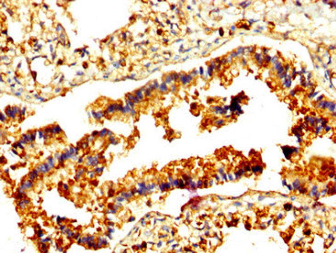 IHC image of CSB-PA019305LA01HU diluted at 1:500 and staining in paraffin-embedded human lung tissue performed on a Leica BondTM system. After dewaxing and hydration, antigen retrieval was mediated by high pressure in a citrate buffer (pH 6.0). Section was blocked with 10% normal goat serum 30min at RT. Then primary antibody (1% BSA) was incubated at 4°C overnight. The primary is detected by a biotinylated secondary antibody and visualized using an HRP conjugated SP system.