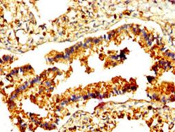 IHC image of CSB-PA019305LA01HU diluted at 1:500 and staining in paraffin-embedded human lung tissue performed on a Leica BondTM system. After dewaxing and hydration, antigen retrieval was mediated by high pressure in a citrate buffer (pH 6.0). Section was blocked with 10% normal goat serum 30min at RT. Then primary antibody (1% BSA) was incubated at 4°C overnight. The primary is detected by a biotinylated secondary antibody and visualized using an HRP conjugated SP system.
