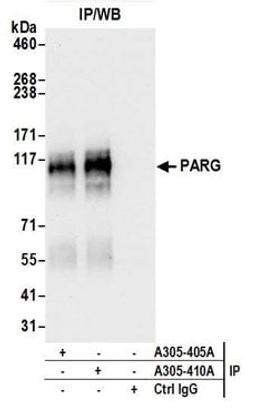 Detection of human PARG by western blot of immunoprecipitates.