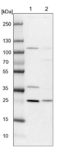 Western Blot: PSF3 Antibody [NBP1-92300] - Lane 1: NIH-3T3 cell lysate (Mouse embryonic fibroblast cells)<br/>Lane 2: NBT-II cell lysate (Rat Wistar bladder tumour cells)