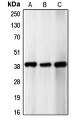 Western blot analysis of SHSY5Y (Lane 1), HeLa (Lane 2), U87MG (Lane 3) whole cell lysates using CDK5R2 antibody