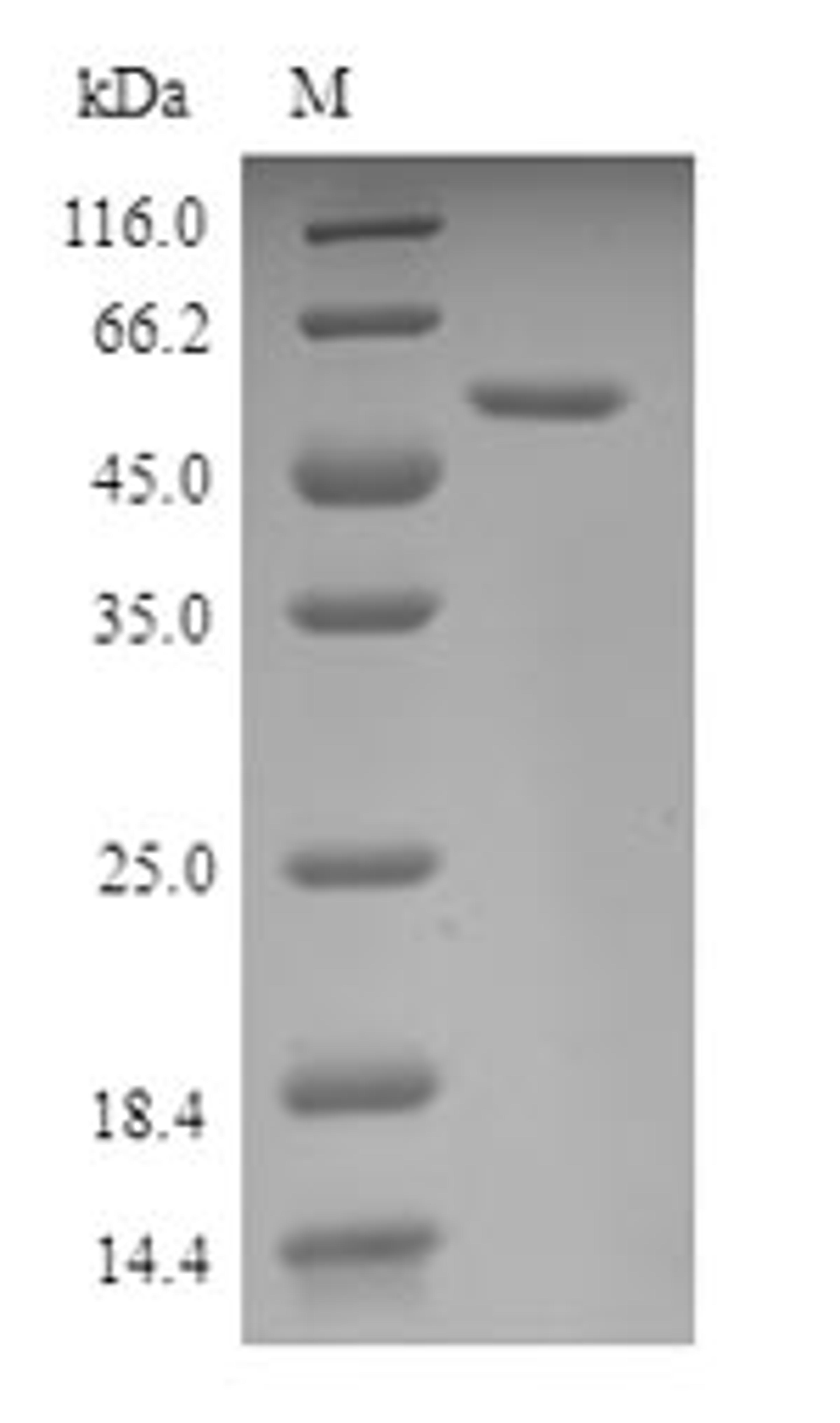 (Tris-Glycine gel) Discontinuous SDS-PAGE (reduced) with 5% enrichment gel and 15% separation gel.