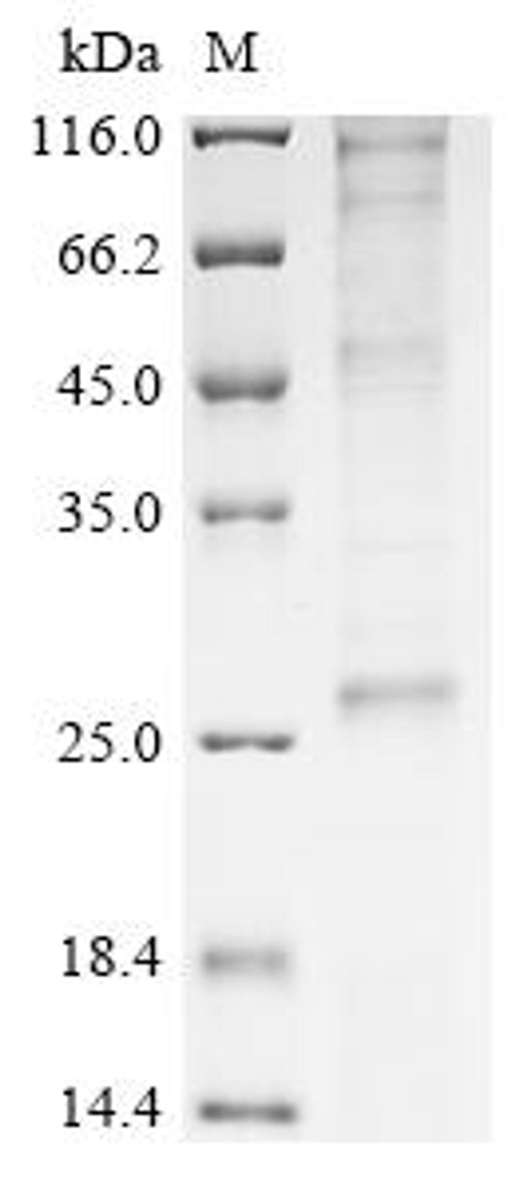 (Tris-Glycine gel) Discontinuous SDS-PAGE (reduced) with 5% enrichment gel and 15% separation gel.