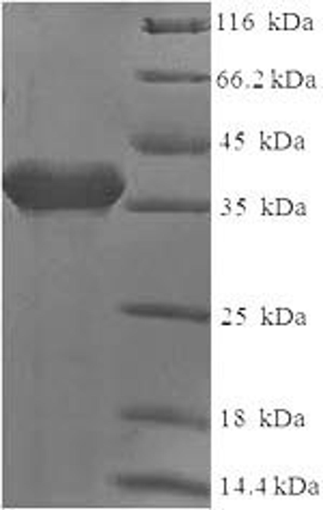 (Tris-Glycine gel) Discontinuous SDS-PAGE (reduced) with 5% enrichment gel and 15% separation gel.