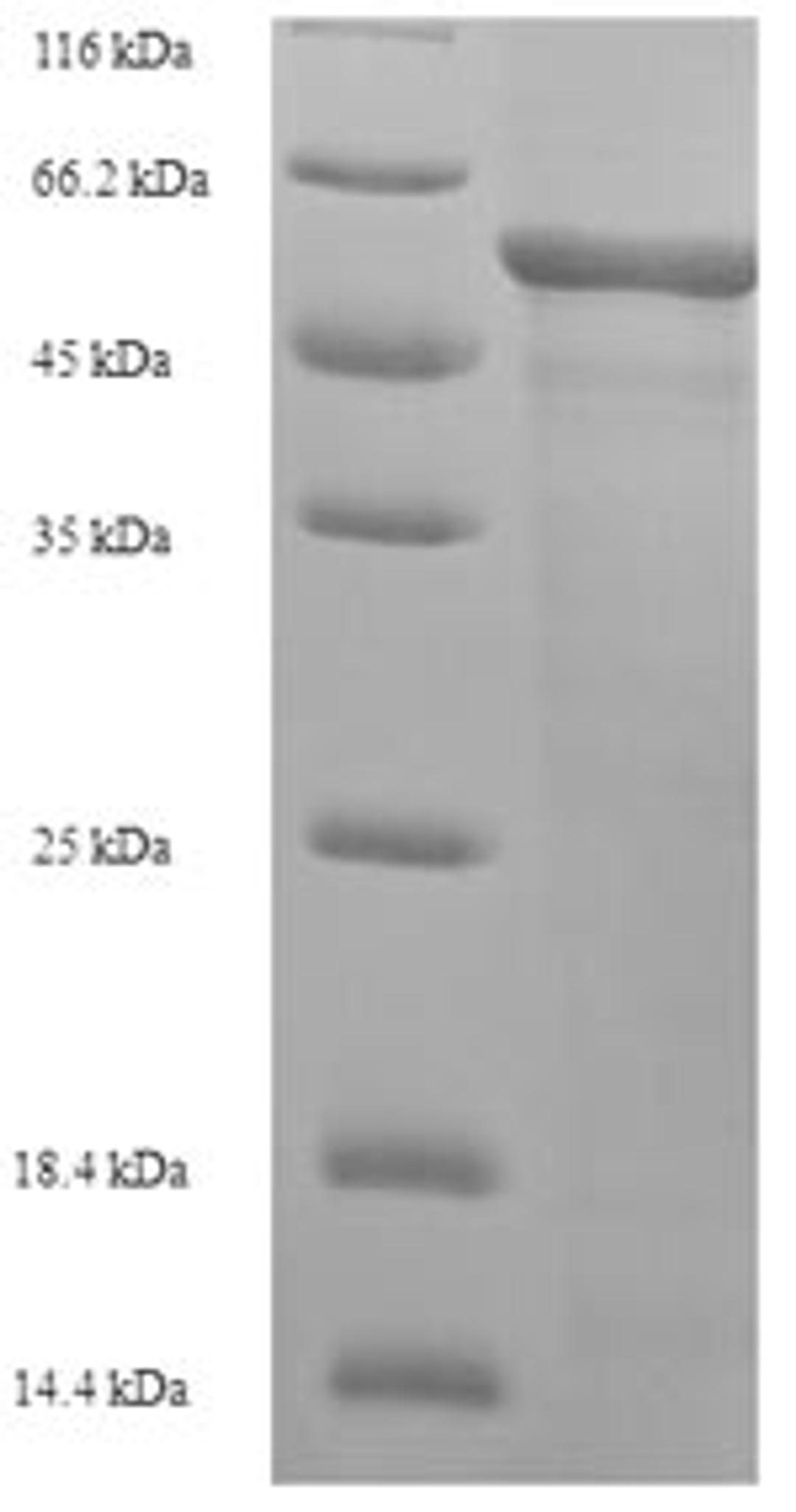 (Tris-Glycine gel) Discontinuous SDS-PAGE (reduced) with 5% enrichment gel and 15% separation gel.