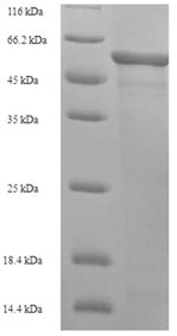 (Tris-Glycine gel) Discontinuous SDS-PAGE (reduced) with 5% enrichment gel and 15% separation gel.