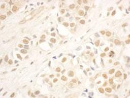 Detection of human NOP58 by immunohistochemistry.