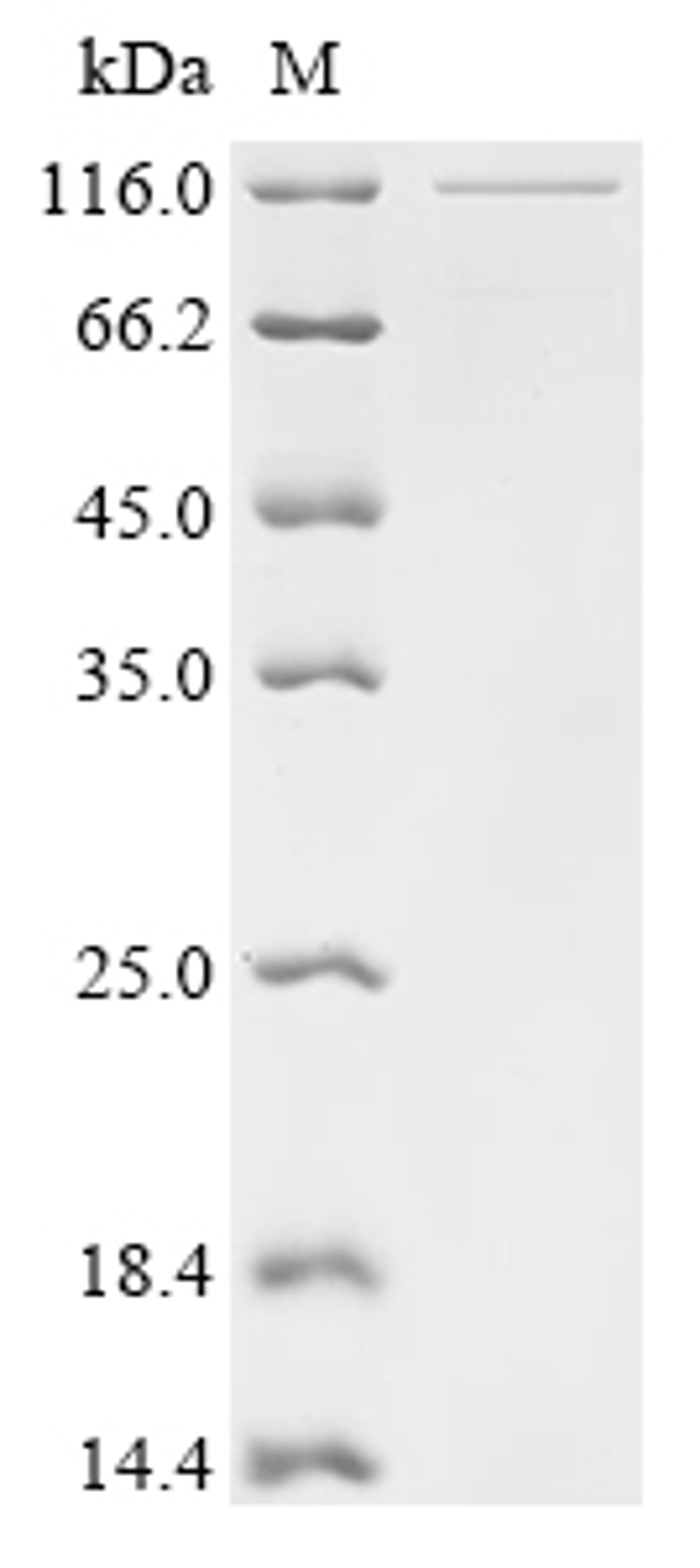 (Tris-Glycine gel) Discontinuous SDS-PAGE (reduced) with 5% enrichment gel and 15% separation gel.