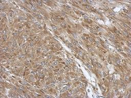 Immunohistochemistry-Paraffin: Pyruvate Dehydrogenase E1 beta subunit Antibody [NBP2-20024] - Immunohistochemical analysis of paraffin-embedded U87 xenograft, using antibody at 1:500 dilution.