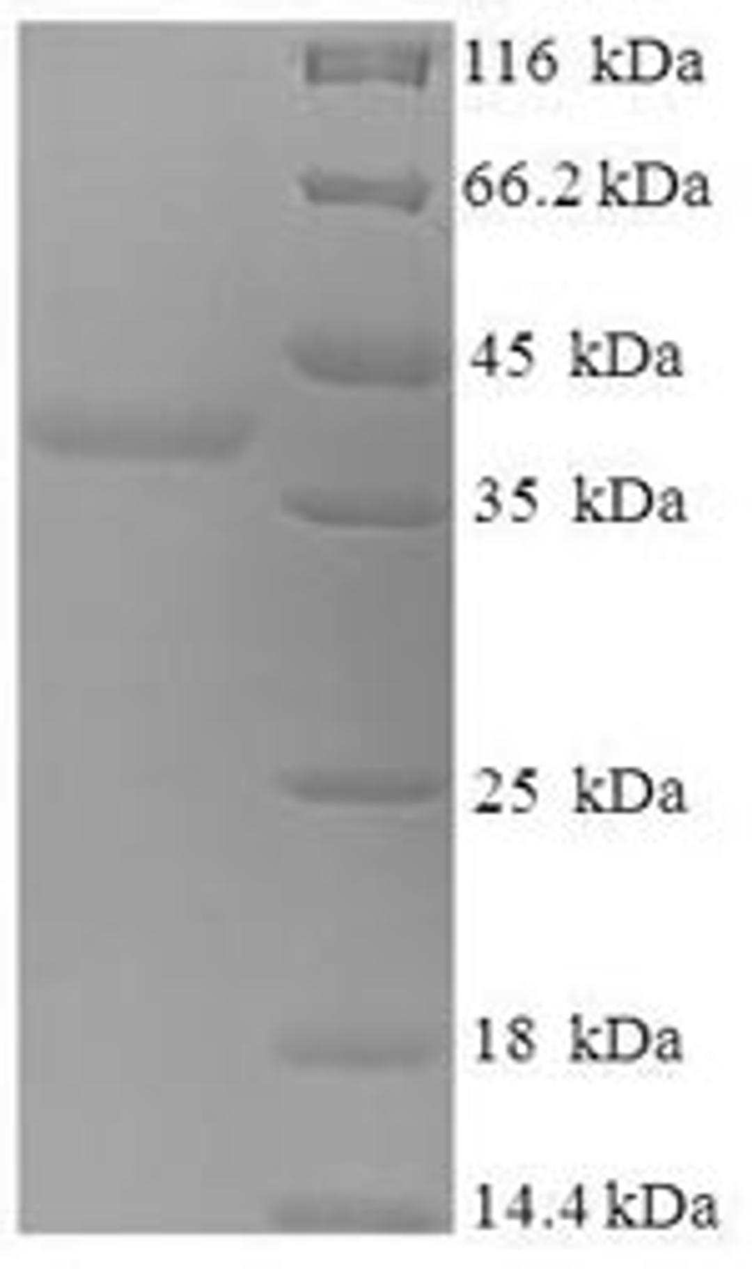 (Tris-Glycine gel) Discontinuous SDS-PAGE (reduced) with 5% enrichment gel and 15% separation gel.