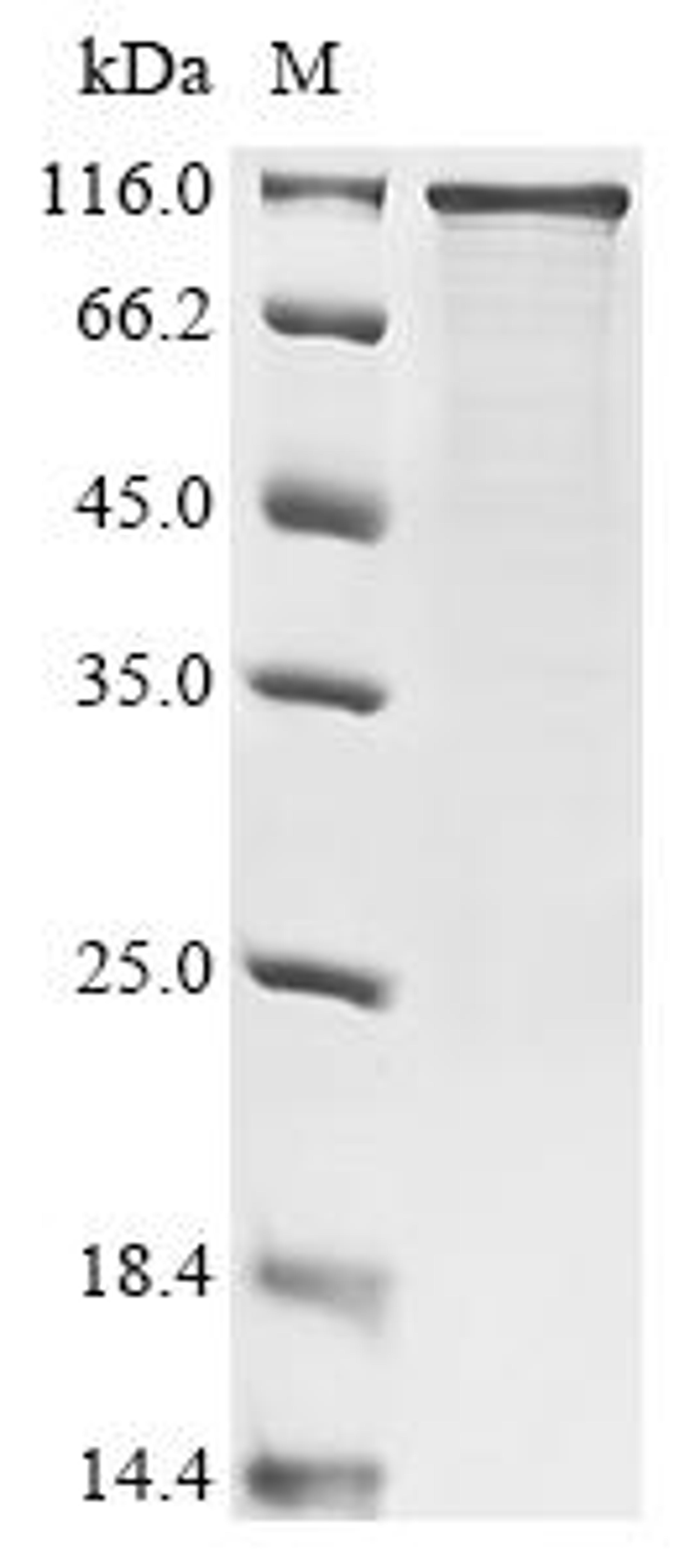 (Tris-Glycine gel) Discontinuous SDS-PAGE (reduced) with 5% enrichment gel and 15% separation gel.