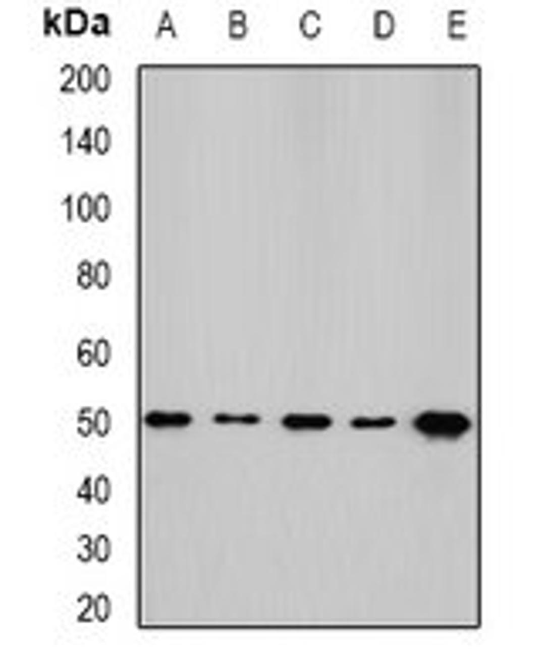 Western blot analysis of HepG2 (Lane1), SKOV3 (Lane2), mouse kidney (Lane3), mouse heart (Lane4), rat liver (Lane5) whole cell lysates using NFS1 antibody