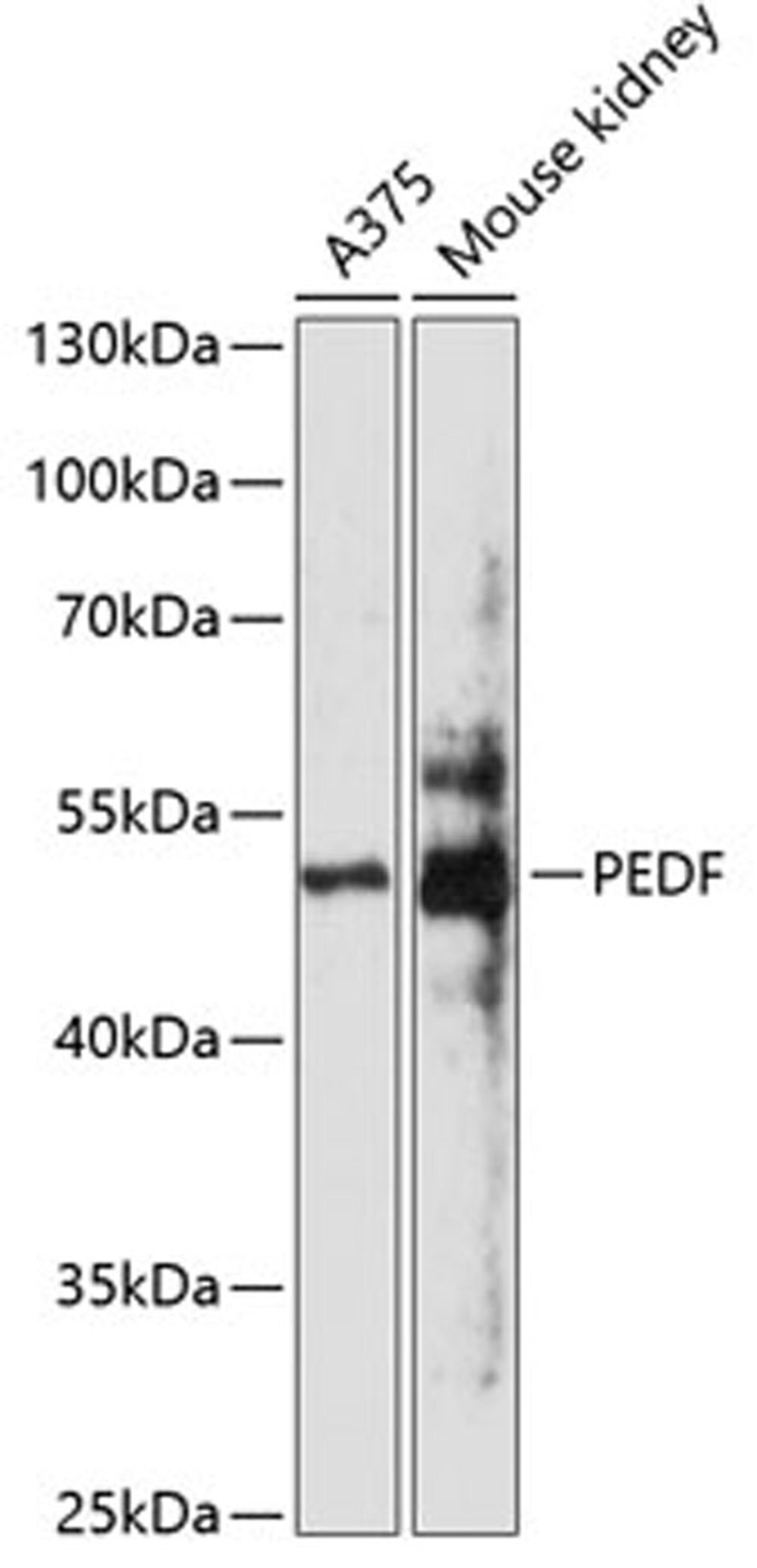 Western blot - PEDF antibody (A1673)