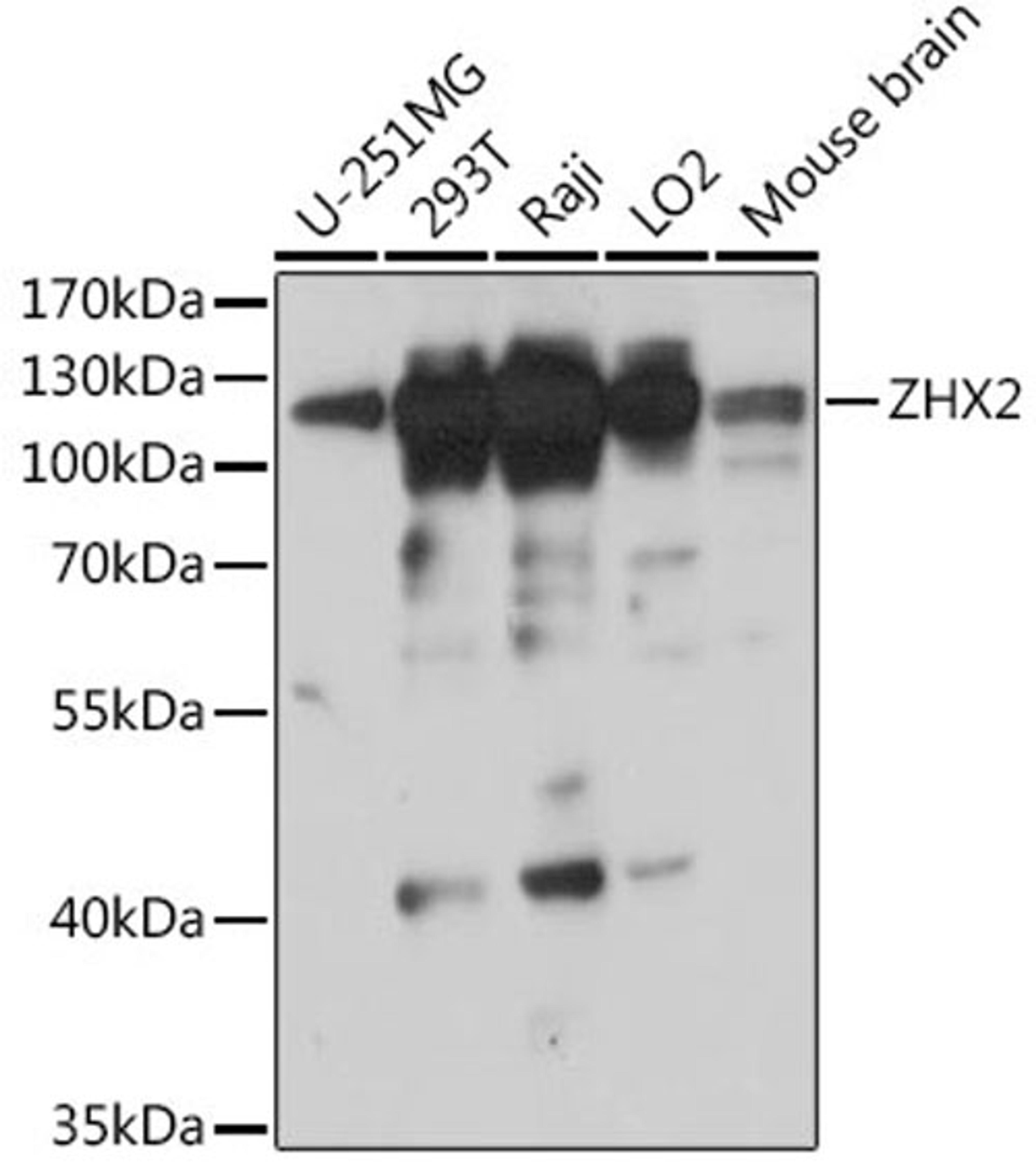 Western blot - ZHX2 antibody (A18235)