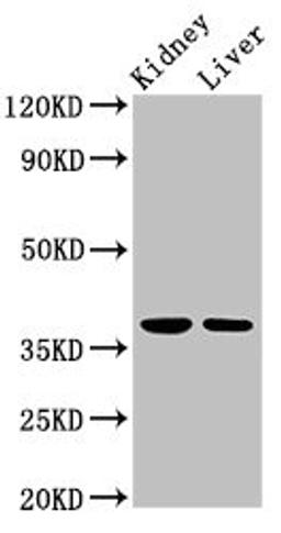 Western Blot. Positive WB detected in: Rat kidney tissue, Mouse liver tissue. All lanes: TAF8 antibody at 2.5ug/ml. Secondary. Goat polyclonal to rabbit IgG at 1/50000 dilution. Predicted band size: 35, 38 kDa. Observed band size: 38 kDa. 