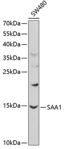 Western blot - SAA1 antibody (A1655)