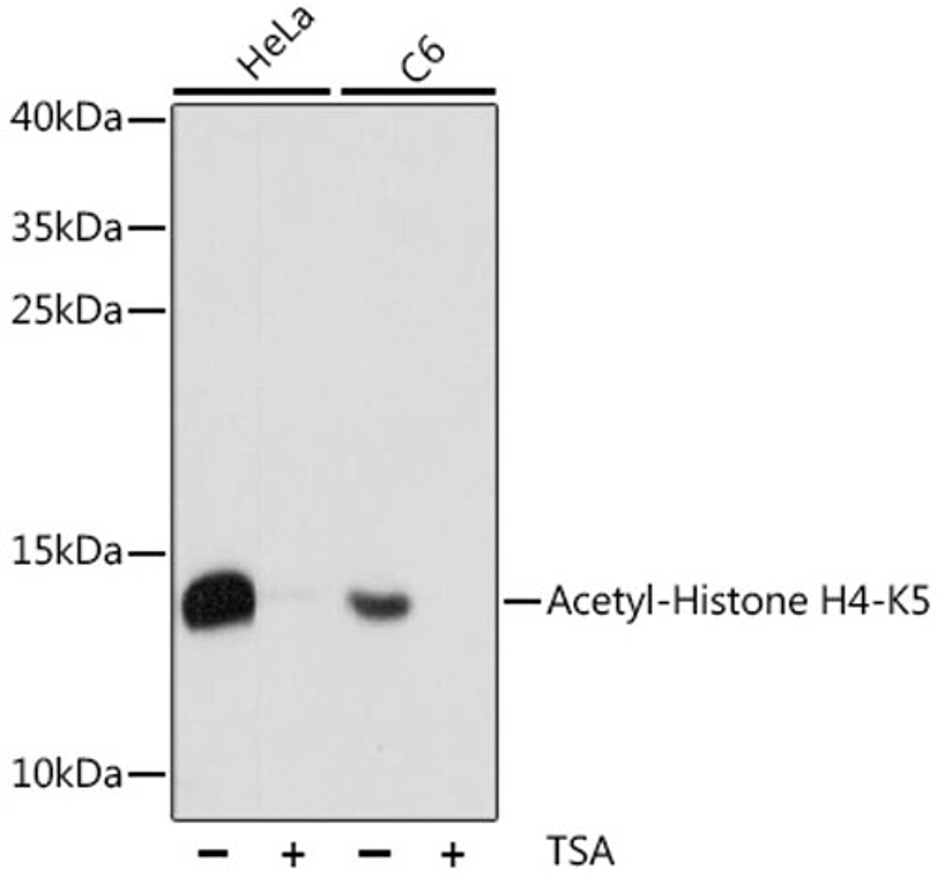 Western blot - Acetyl-Histone H4-K5 antibody (A15233)