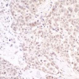 Detection of human PAF49 by immunohistochemistry.