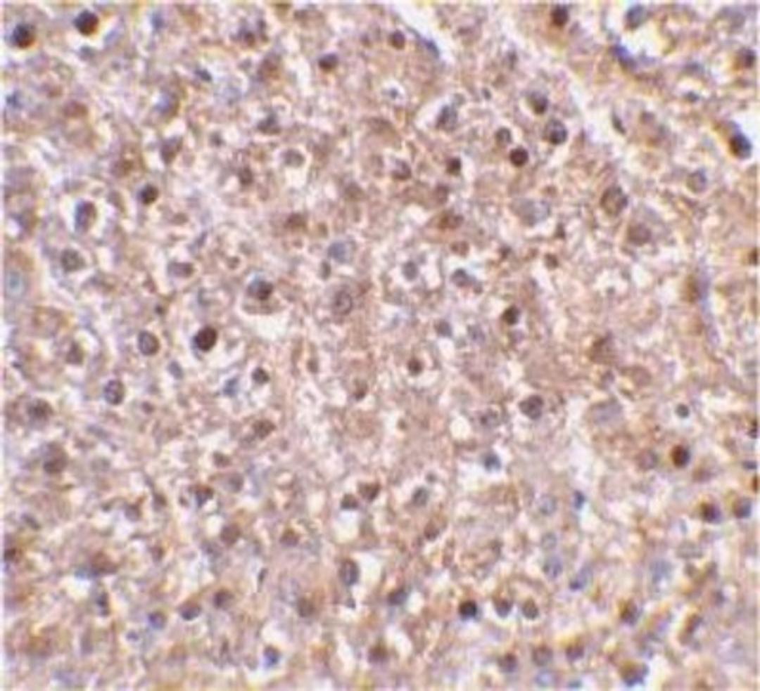 Immunohistochemistry-Paraffin: Caspase 12 Antibody [NBP1-76801] - Mouse liver tissue using caspase-12 antibody at 2 ug/ml.