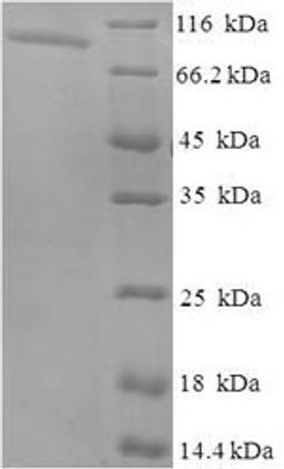 (Tris-Glycine gel) Discontinuous SDS-PAGE (reduced) with 5% enrichment gel and 15% separation gel.