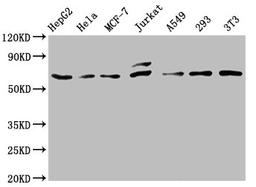 Western Blot. Positive WB detected in: HepG2 whole cell lysate, Hela whole cell lysate, MCF-7 whole cell lysate, Jurkat whole cell lysate, A549 whole cell lysate, 293 whole cell lysate, NIH/3T3 whole cell lysate. All lanes: c-FOS antibody at 0.81μg/ml. Secondary. Goat polyclonal to rabbit IgG at 1/50000 dilution. Predicted band size: 41, 29, 37 KDa. Observed band size: 62 KDa. 