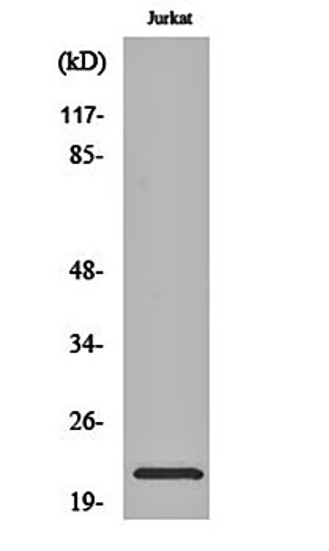 Western blot analysis of Jurkat cell lysates using NTPase antibody