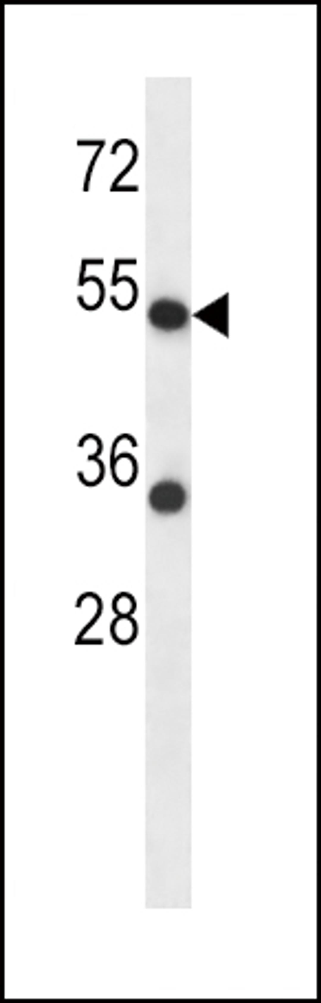 Western blot analysis in HepG2 cell line lysates (35ug/lane).