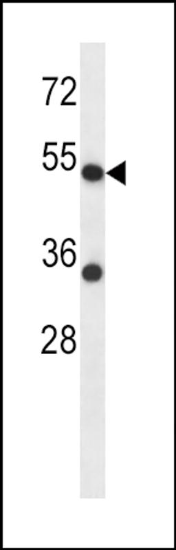 Western blot analysis in HepG2 cell line lysates (35ug/lane).