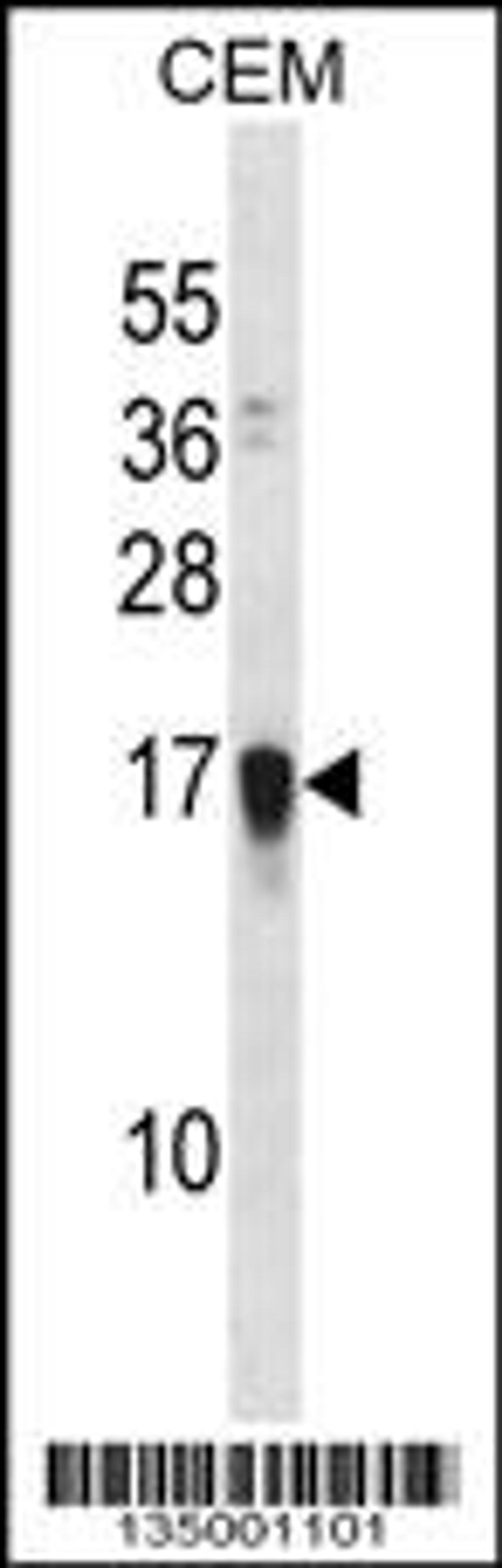 Western blot analysis in CEM cell line lysates (35ug/lane).