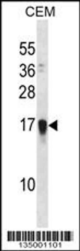 Western blot analysis in CEM cell line lysates (35ug/lane).