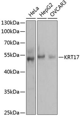 Western blot - KRT17 antibody (A0123)