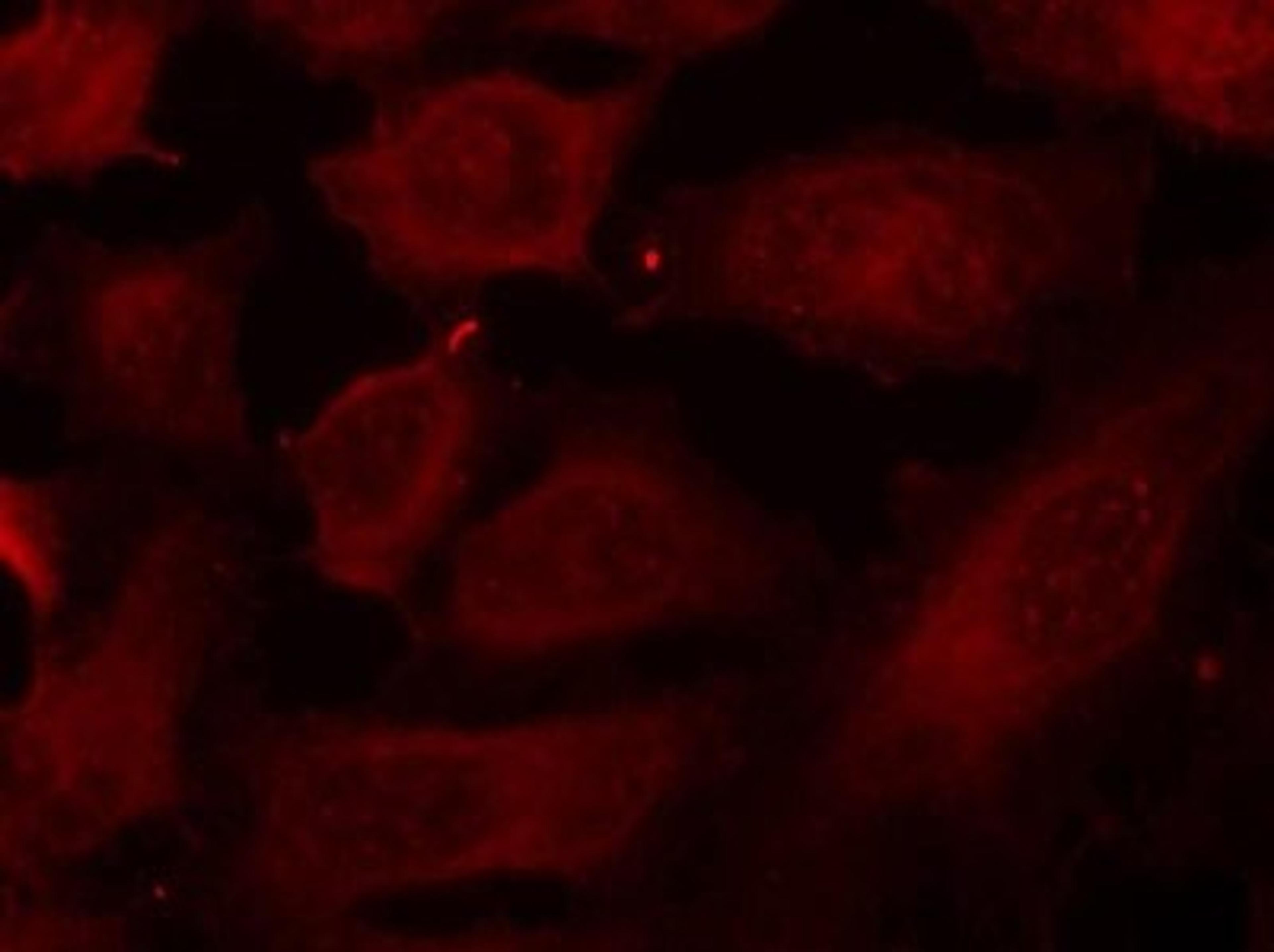 Immunocytochemistry/Immunofluorescence: DOK2 [p Tyr299] Antibody [NB100-82109] - Staining of methanol-fixed Hela cells using p56Dok-2(Phospho-Tyr299) antibody