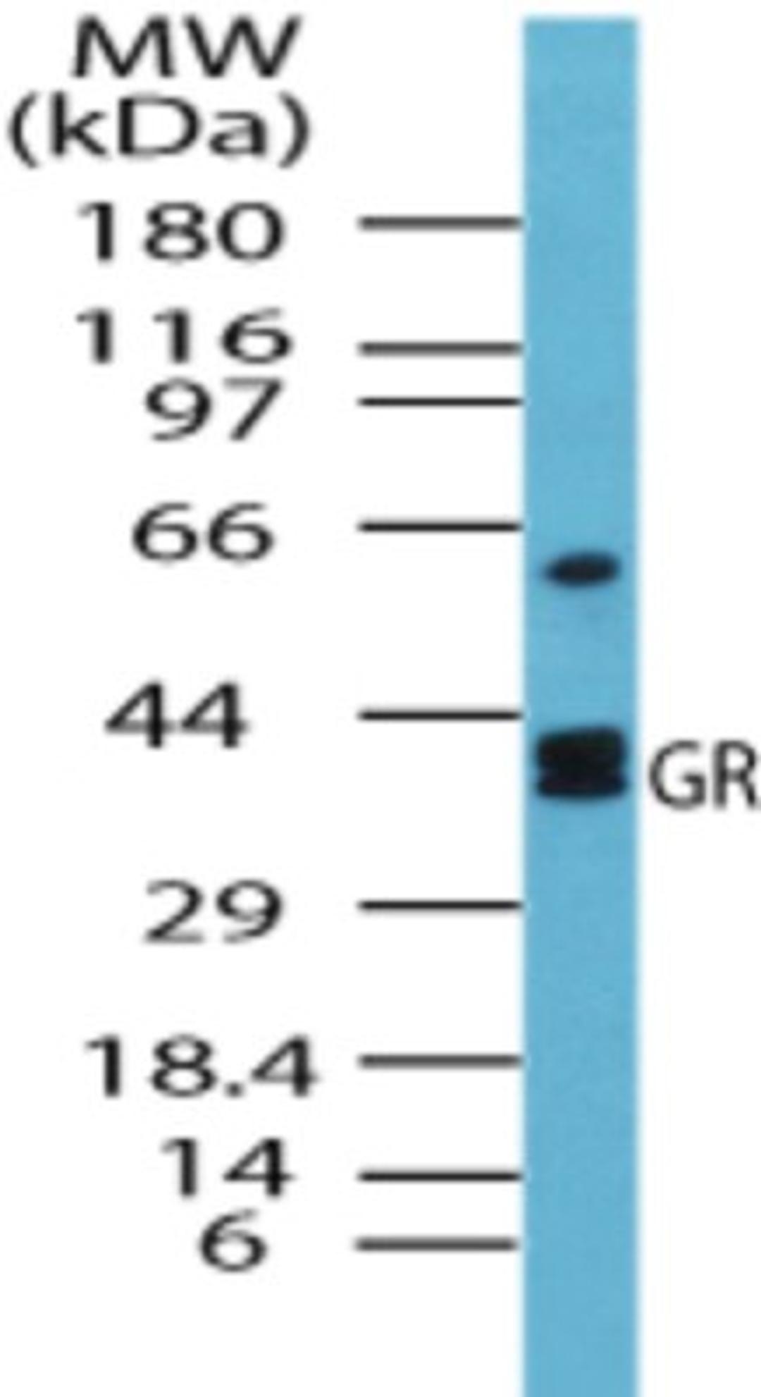 Western Blot: Glutathione Reductase Antibody [NBP2-24940] - analysis of GR (2- Glutathione reductase from S. cerevisiae) in human liver lysate using this antibody. 5 ug/ml.