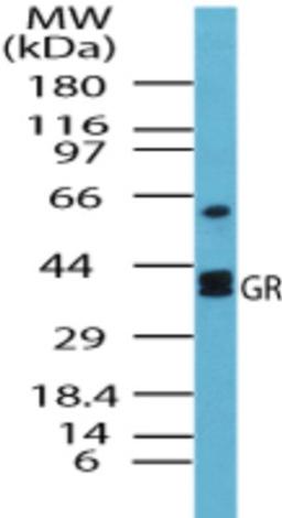 Western Blot: Glutathione Reductase Antibody [NBP2-24940] - analysis of GR (2- Glutathione reductase from S. cerevisiae) in human liver lysate using this antibody. 5 ug/ml.