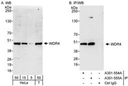 Detection of human WDR4 by western blot and immunoprecipitation.