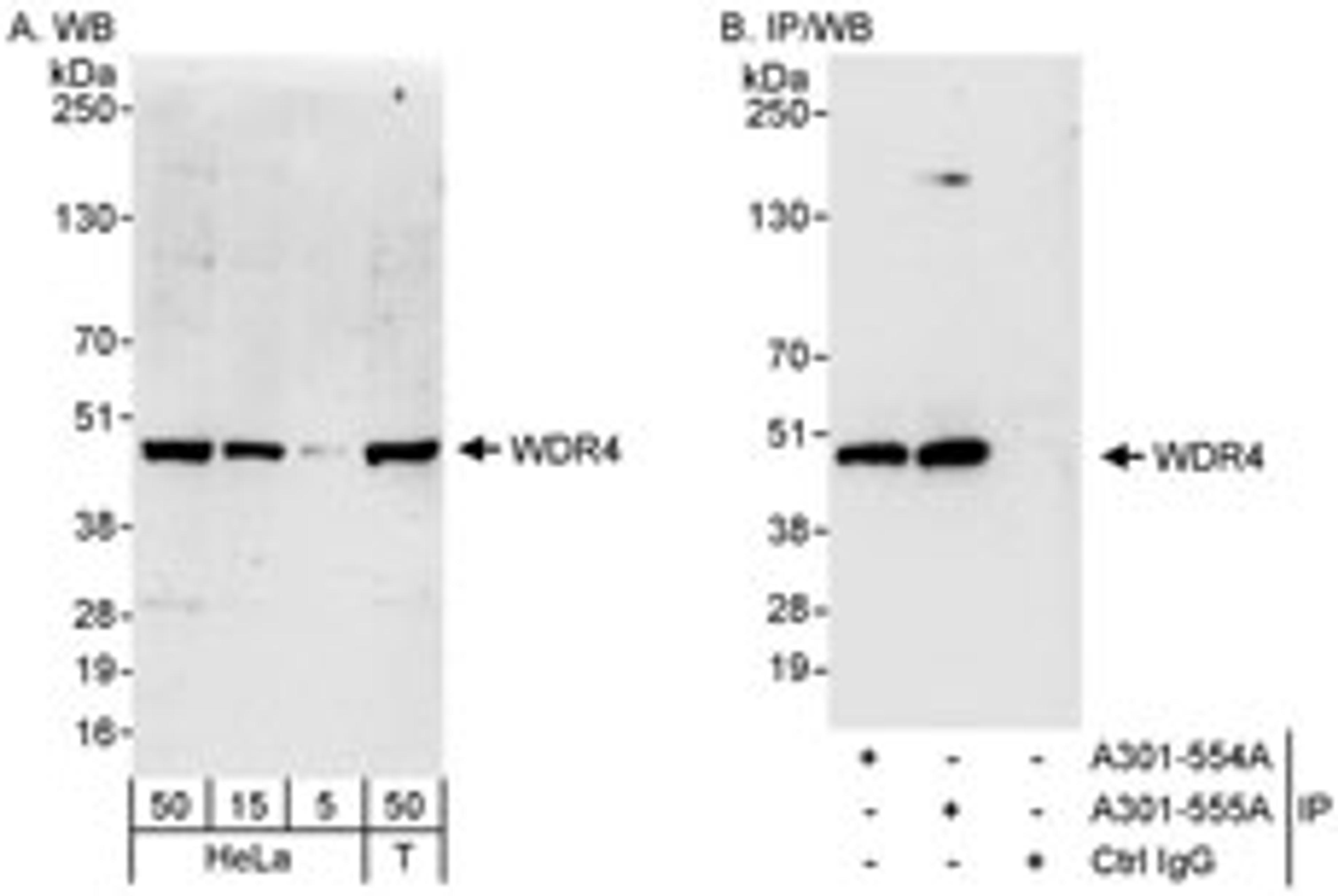 Detection of human WDR4 by western blot and immunoprecipitation.