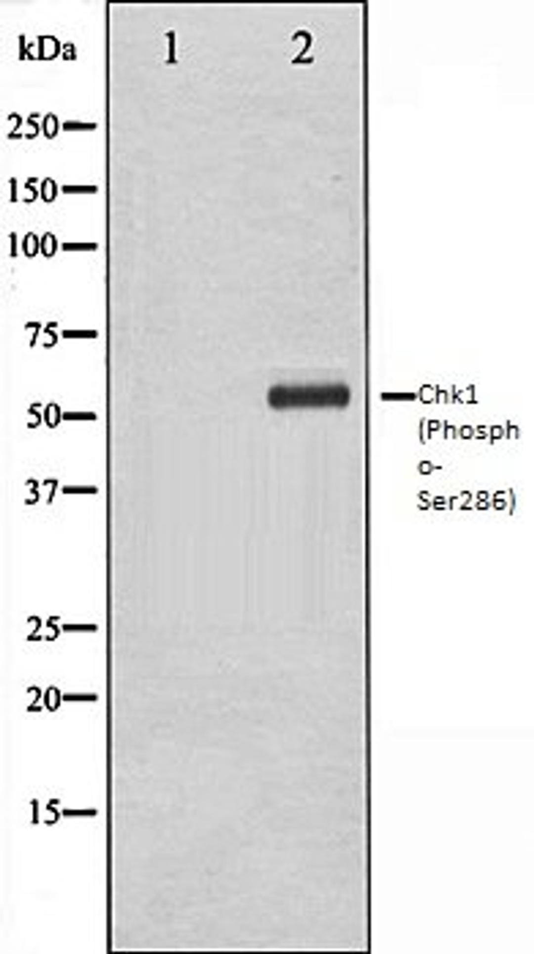 Western blot analysis of K562 whole cell lysates using Chk1 (Phospho-Ser286) antibody, The lane on the left is treated with the antigen-specific peptide.