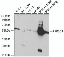 Western blot - PPP3CA antibody (A1063)