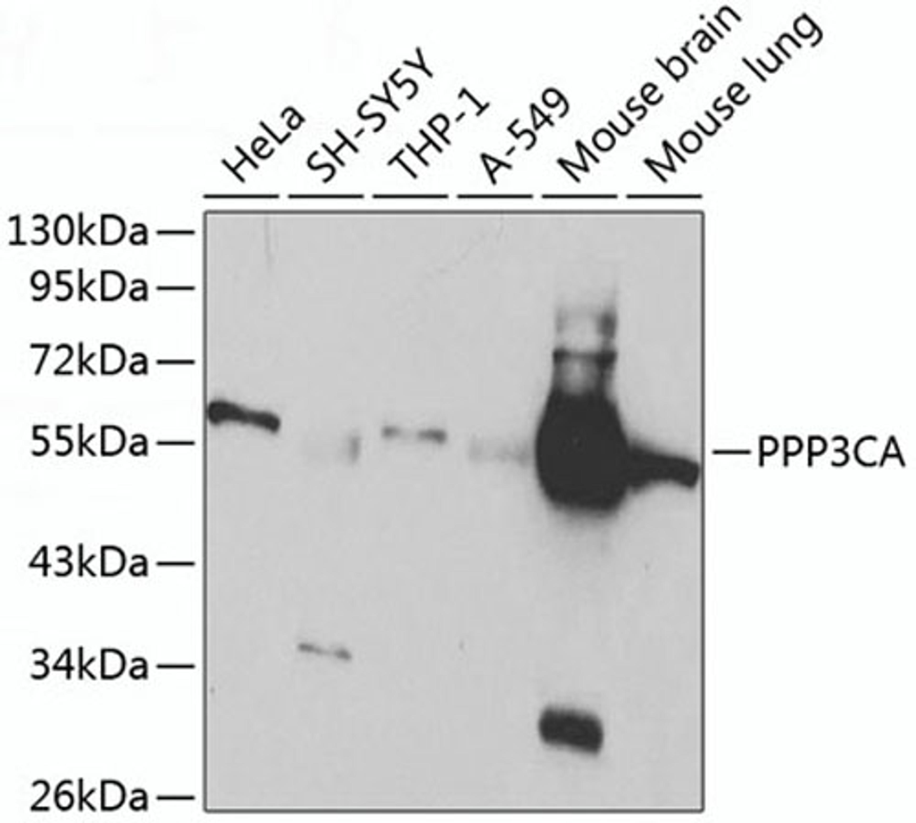 Western blot - PPP3CA antibody (A1063)