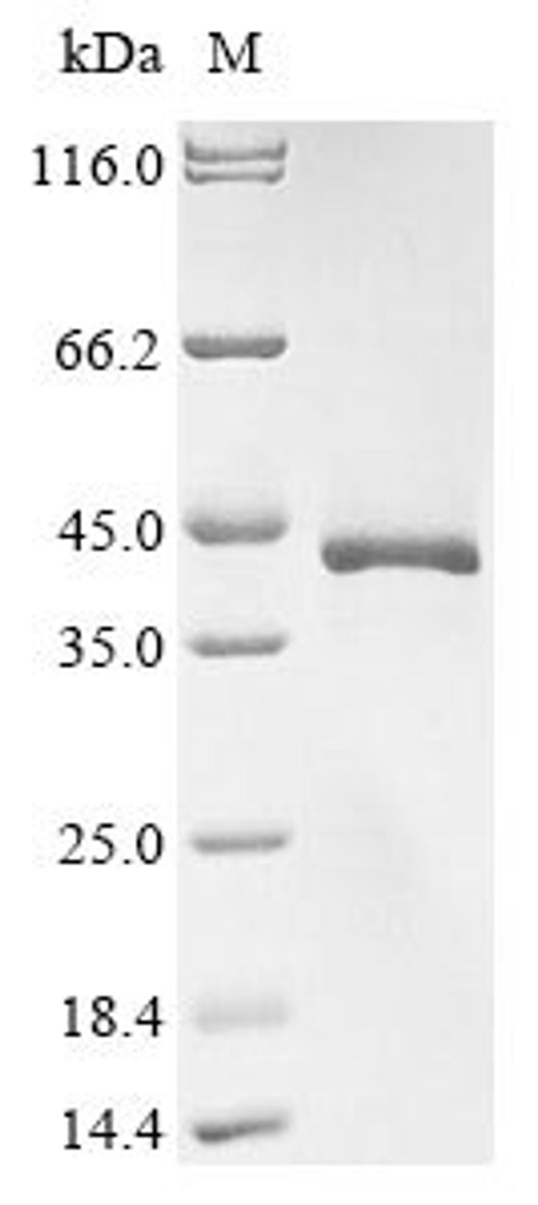 (Tris-Glycine gel) Discontinuous SDS-PAGE (reduced) with 5% enrichment gel and 15% separation gel.
