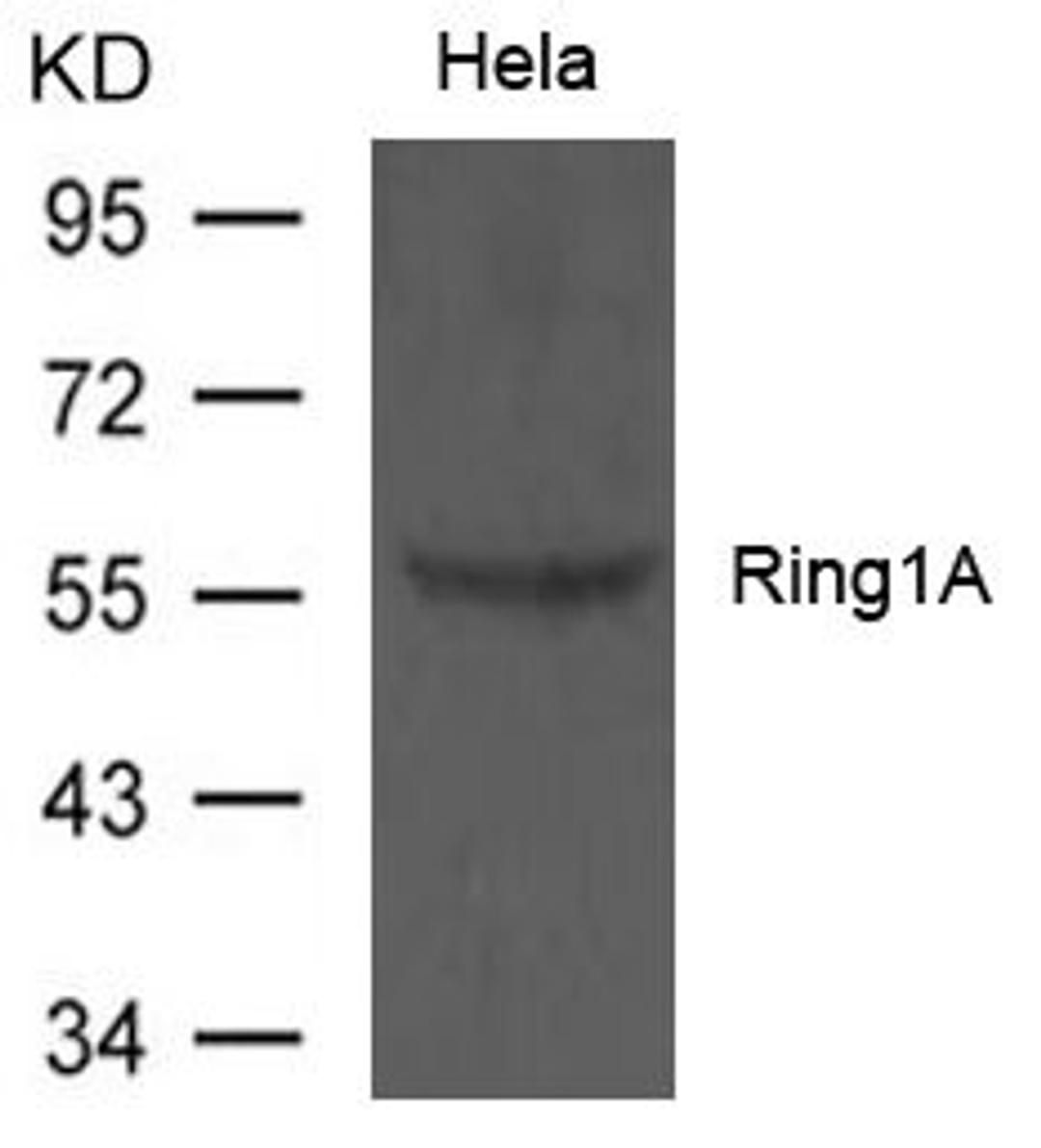 Western blot analysis of Hela cells using Ring1A antibody