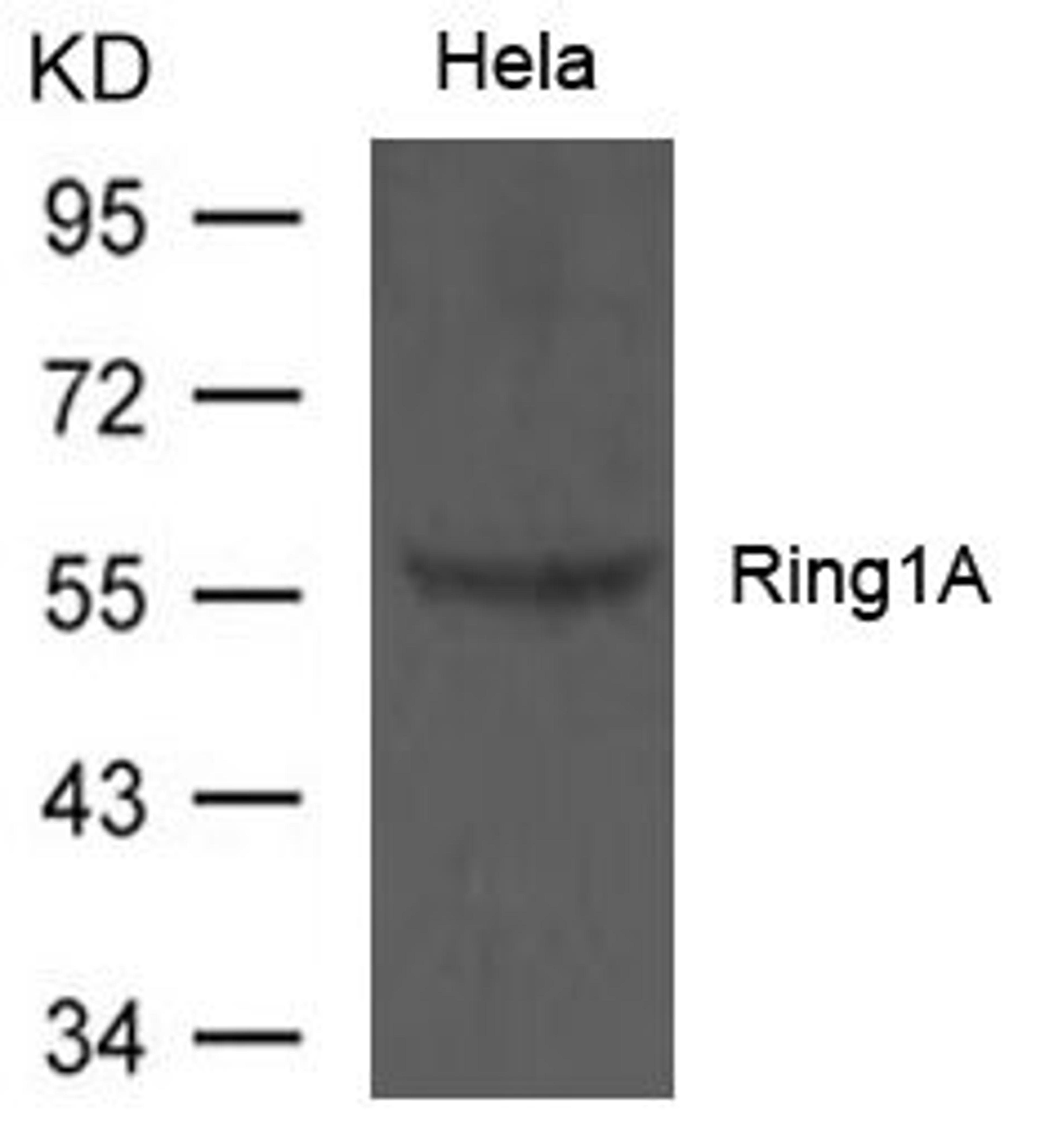 Western blot analysis of Hela cells using Ring1A antibody