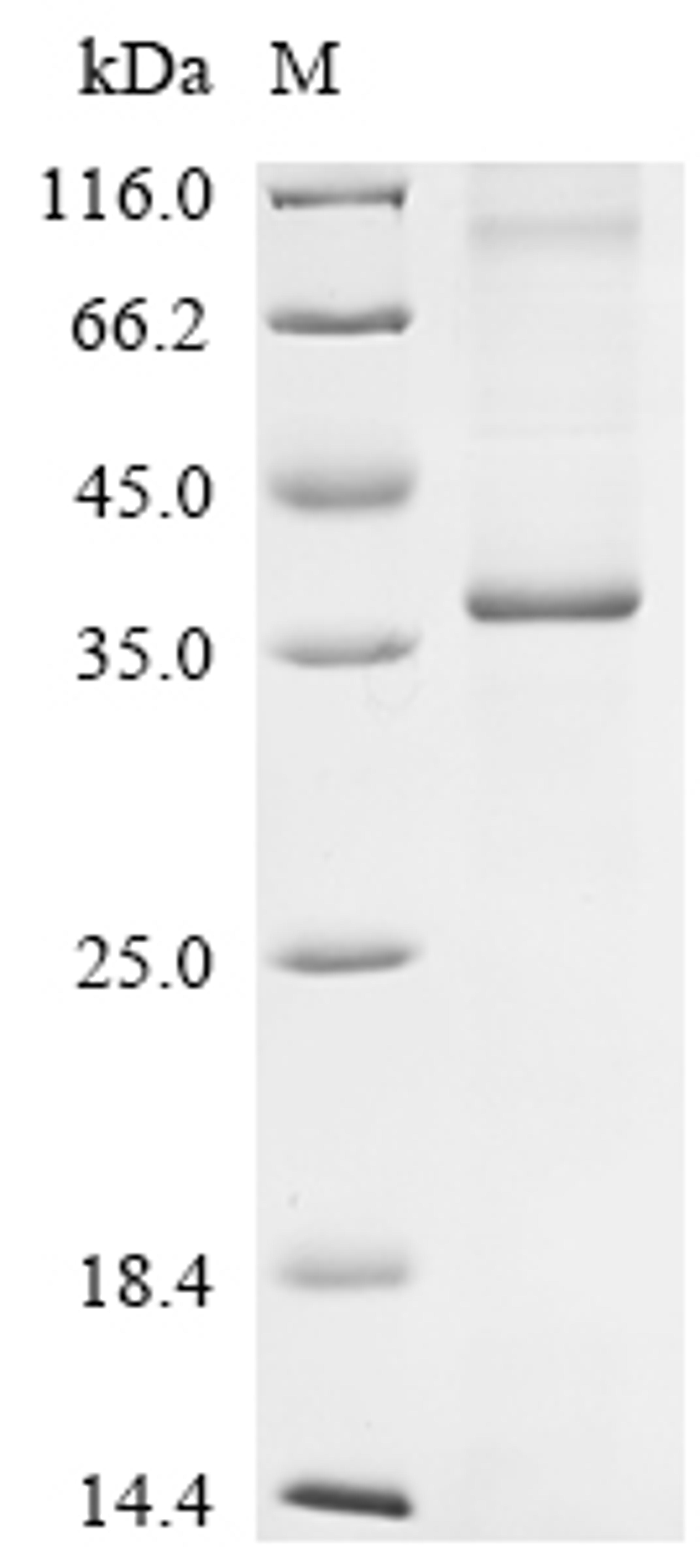(Tris-Glycine gel) Discontinuous SDS-PAGE (reduced) with 5% enrichment gel and 15% separation gel.
