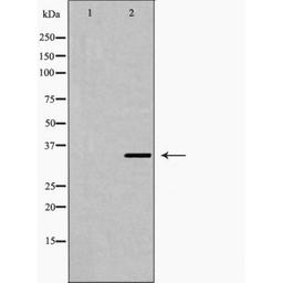 Western blot analysis of LOVO cell using Fra 2 antibody