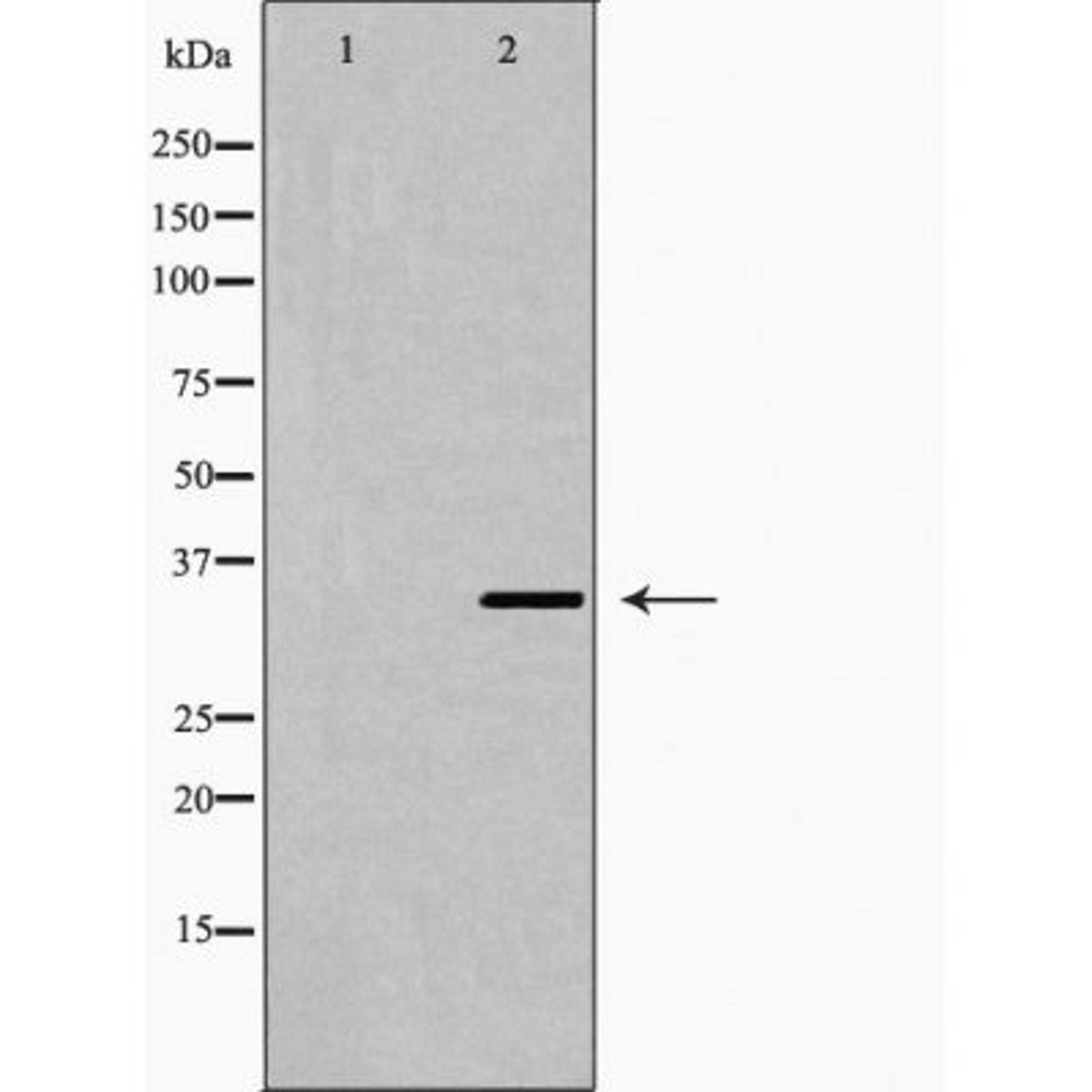 Western blot analysis of LOVO cell using Fra 2 antibody