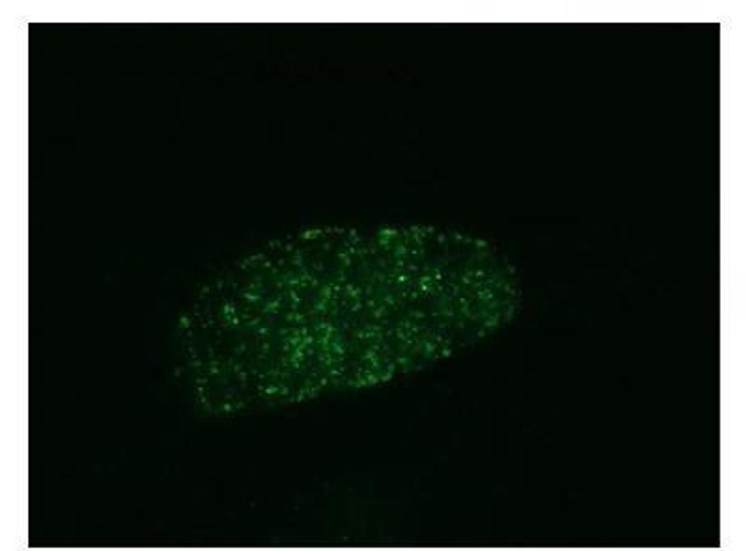 Immunocytochemistry/Immunofluorescence: RPA2 [p Ser33] Antibody [NB100-544] - Localization of phosphorylated RPA32 to foci following treatment with CPT. Samples: Asynchronous U2OS cells treated with CPT (1 uM, 1 hr). Antibody: NB 100-544 used at 2 ug/ml. Detection: FITC conjugated anti-rabbit IgG.